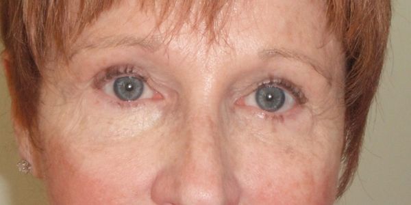 Before and After permanent makeup