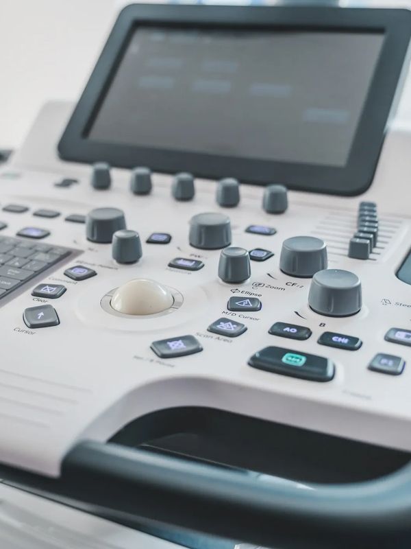 Close-up of a modern ultrasound machine with controls and screen.