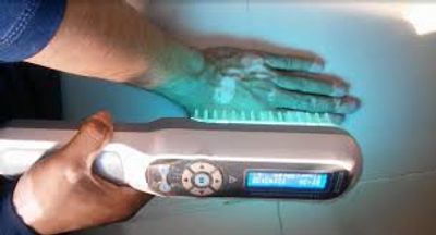 Hand undergoing a UV light skin examination with a handheld device.