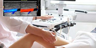 Doppler or Duplex Vascular Extremities Ultrasound