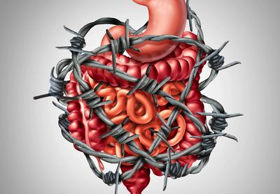 barbed wire around human gut system shows gut pain in fibromyalgia