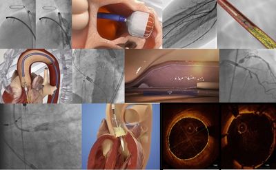 Collage of medical images showing cardiovascular procedures and imaging techniques.