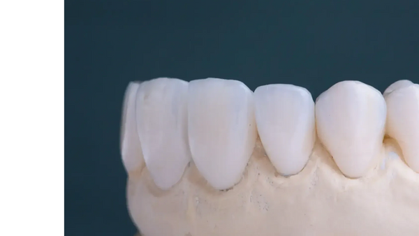 dental crowns