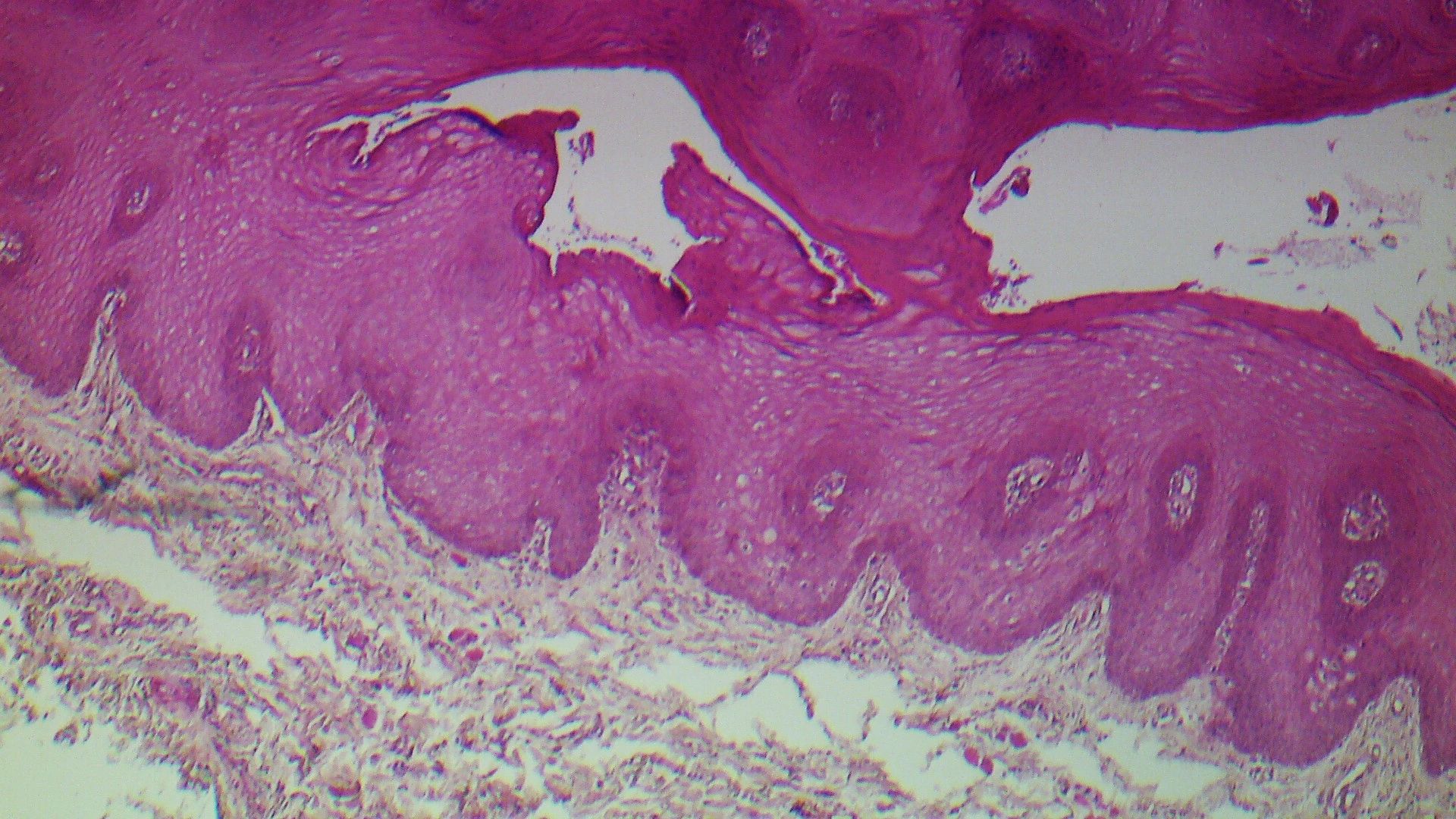 Oral Medicine for Jaw Joint pain/TMJ Problems MelbourneOral Mucosal