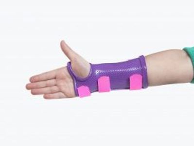 Custom-hand-splinting