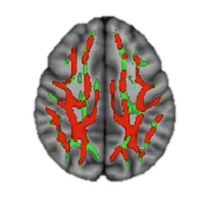 Comparison of Superior Cognitive Region of Brains
