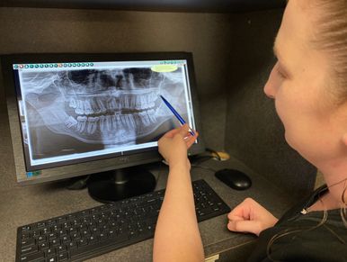 Watertown Wisdom Teeth