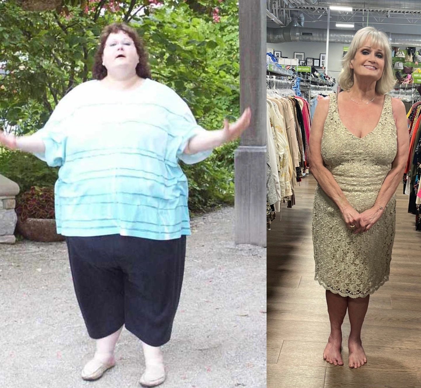 Before and after weight loss transformation of a woman.