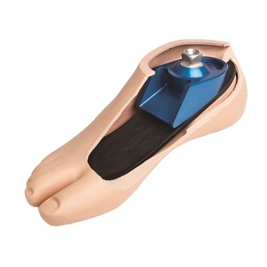 Prosthetic foot with blue adjustable ankle joint inside a flesh-colored foot shell.