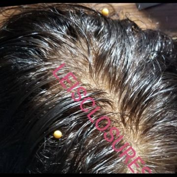 monofilament closure