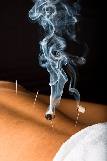 Moxibustion, acupuncture