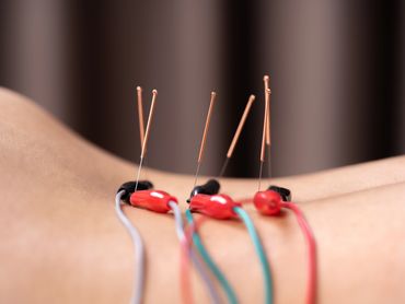 Electroacupuncture, acupuncture