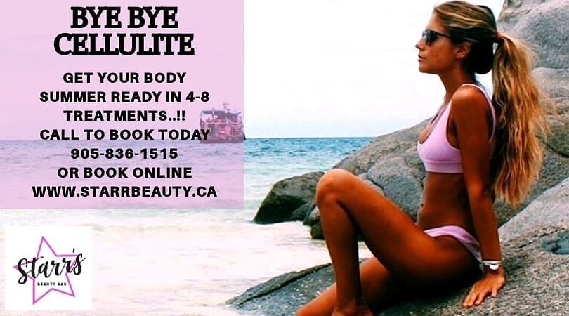 cellulite, weight-loss, fat, stretch marks, newmarket, beauty