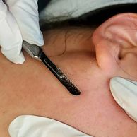 microblading, eyebrows, toronto, tattoo medical spa nail salons nearby Newmarket Barrie dermaplaning