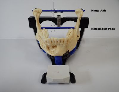 Using anatomical landmarks to orient your specific jaw to the machine on hinge axis for optimum accu