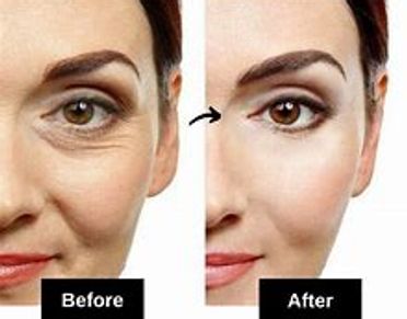 woman show skin type before and after red-light therapy