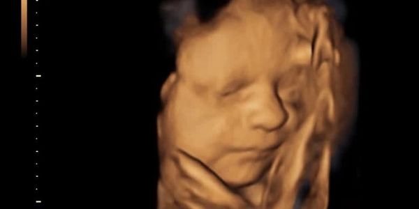 3d/4d scan
ultrasound pregnancy scan 
gender scan
early scan
pregnancy scan
private pregnancy scan