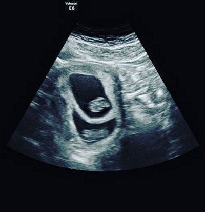 3d/4d scan
ultrasound pregnancy scan
gender scan
early scan
pregnancy scan
private pregnancy scan