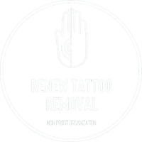 Renew Tattoo Removal