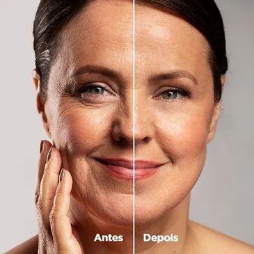 Renove a beleza da sua pele e recupere sua auto estima!