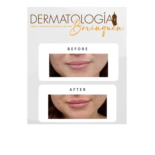 Treatment results