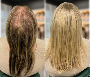 hair topper for thinning hair and or bald spot