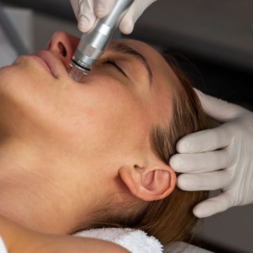 Rostro de mujer jóven recostada y muy relajada recibiendo una Limpieza Facial con Hidrodermoabrasión