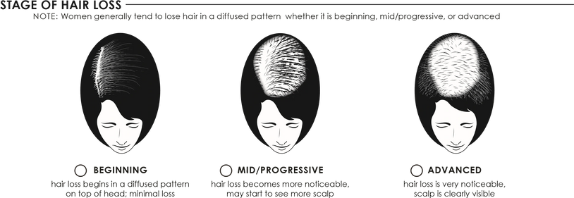 Canada's most educated & honest online wig boutique for Wigs and Jon Renau Wigs & Toppers