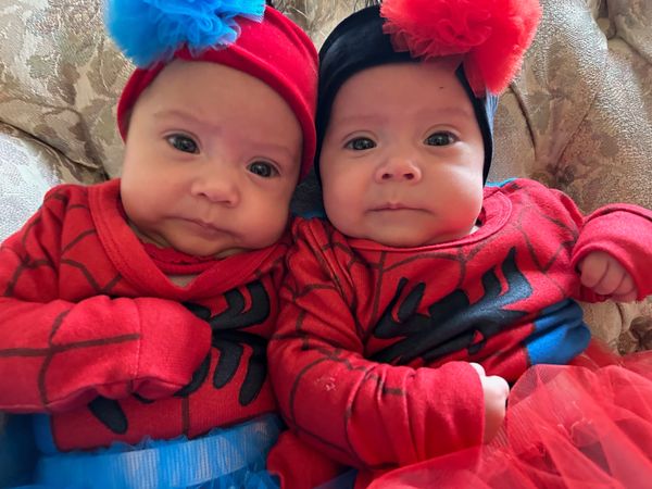 Twins treated with fetal surgery for TTTS at Primary Childrens Hospital in Salt Lake City, Utah