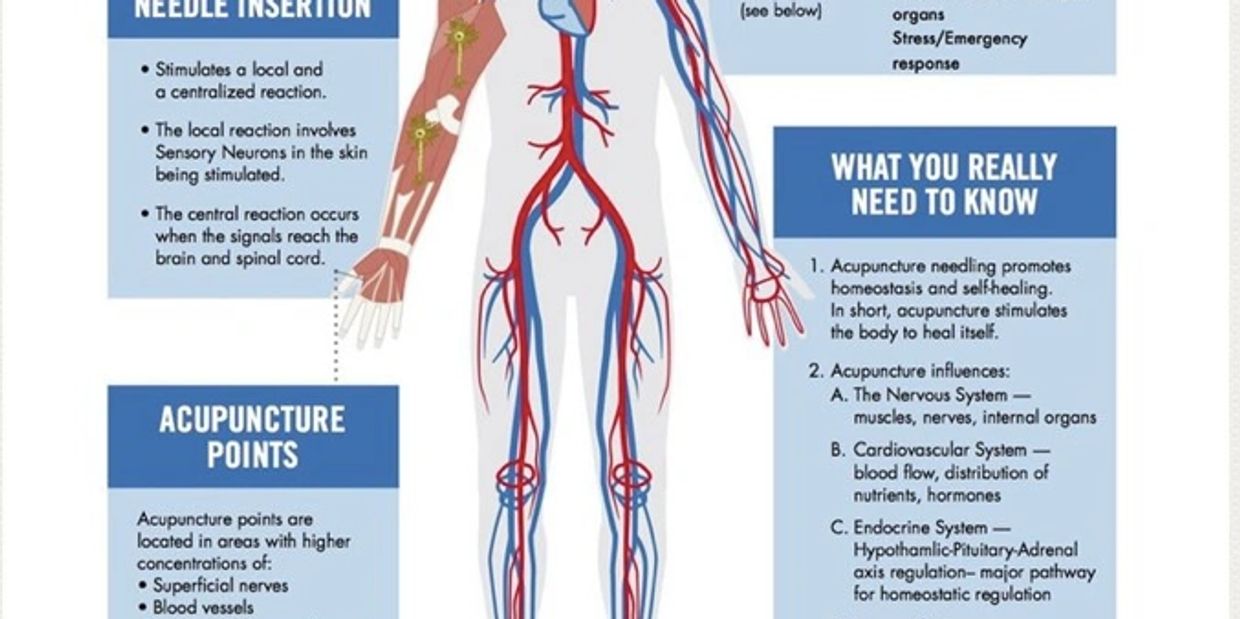 How acupuncture works