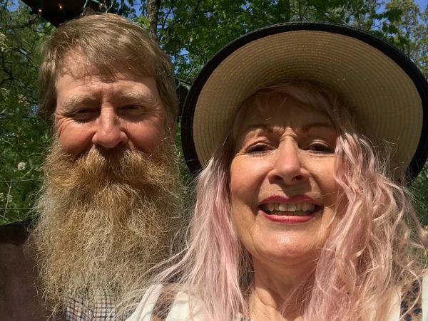 Smiling couple outdoors with trees and blue sky in the background.