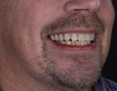 Man smiling, half of lower face.