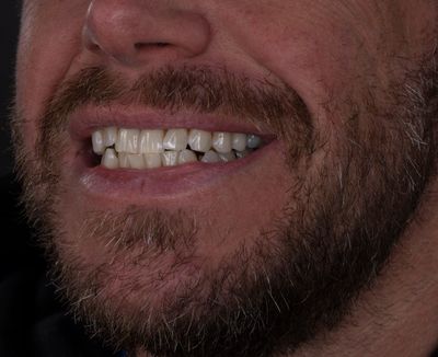 Man smiling, half of lower face.