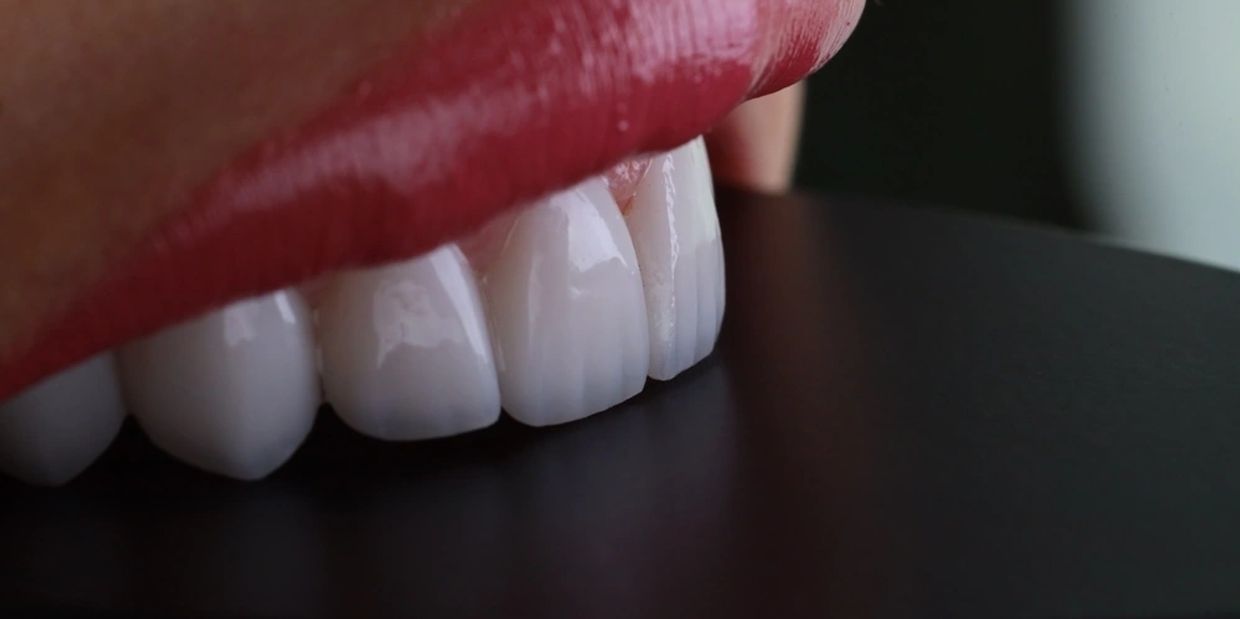 Close-up of glossy red lips and white teeth against a dark background.