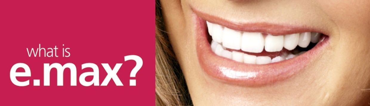 Close-up of a smiling mouth with bright white teeth, next to text asking 'what is e.max?'.