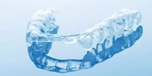 Thickness of the full arch night guard varies depending on the patient's needs.