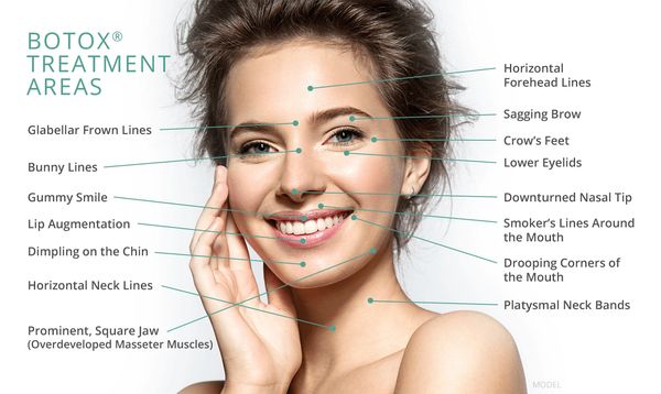BOTOX®