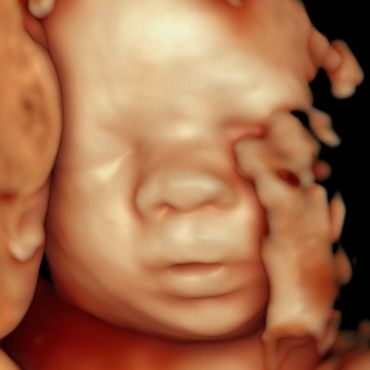5D hd live ultrasound image at 4d baby studio