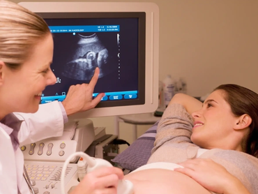 Dawn pointing at the ultrasound screen to show a client their baby at 4d baby studio