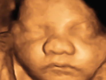 cute 3d ultrasound image of baby's face