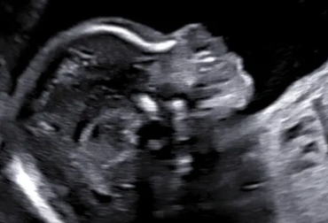2d ultrasound image of baby's profile at 4d baby studio