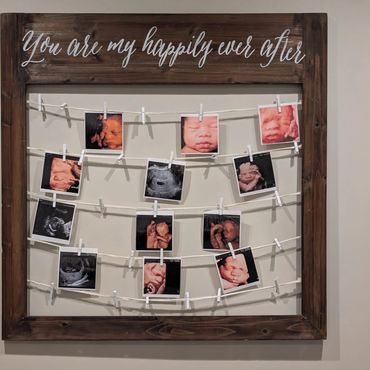 Framed ultrasound collage at 4d baby studio in phoenix az