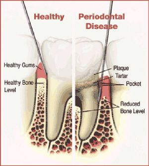 South OC Perio Gum Disease