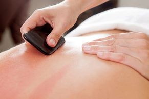 Taking Care of Me: Acupuncture Health and Wellness. Traditional Chinese Medicine. Gua Sha.