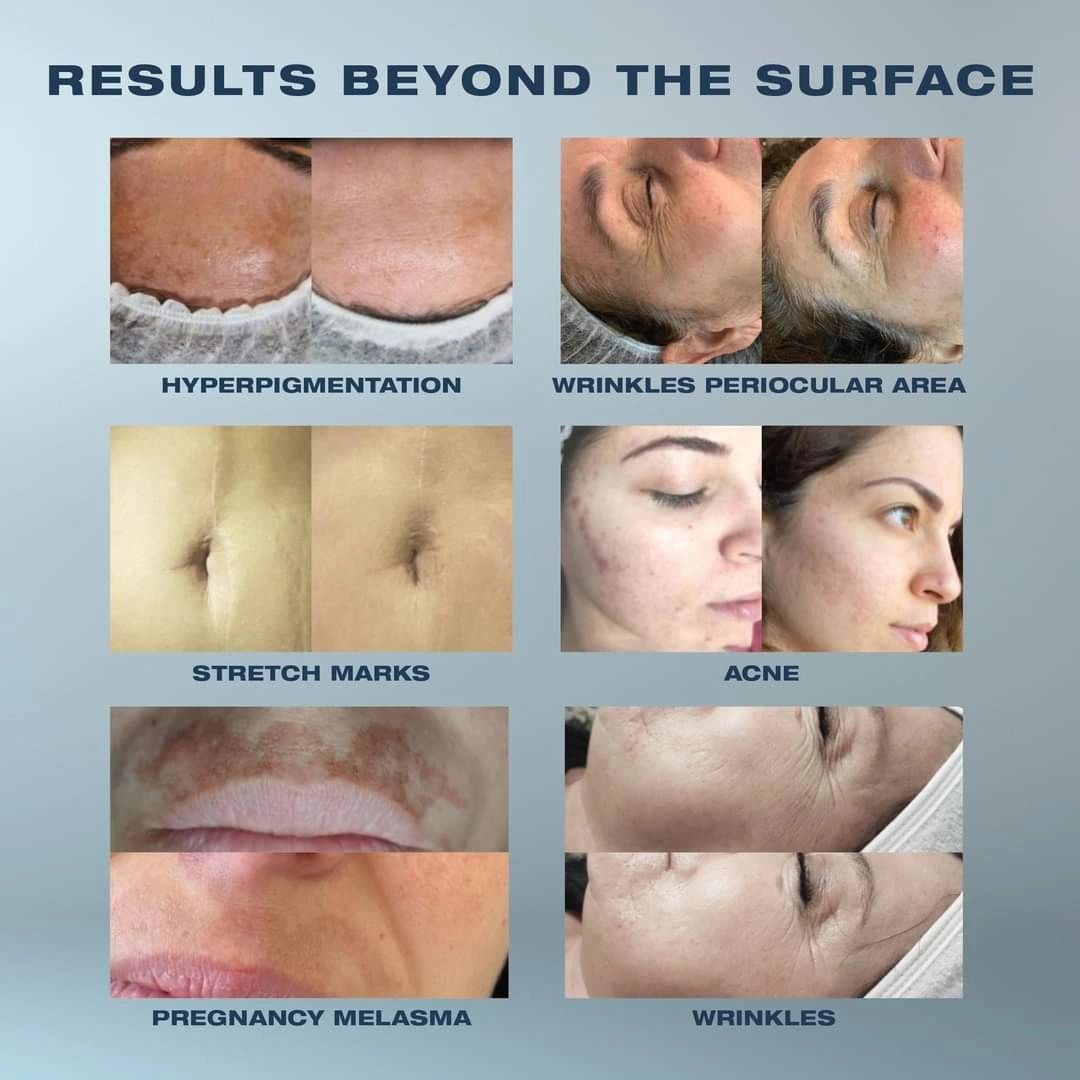 Before and after skincare treatment results on various skin issues.