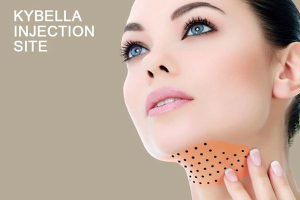 kybella injection site 