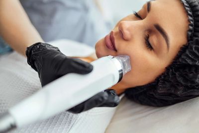 woman receiving a micro needling treatment 
