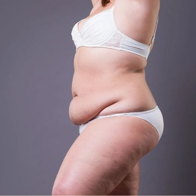 womans body posing in white undergarments 
