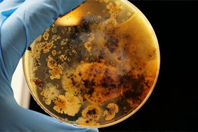 bacteria in a petri dish