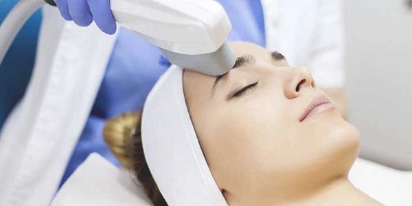 IPL, laser genesis, fraxel, facial, photofacial, cutera, elos, medical spa